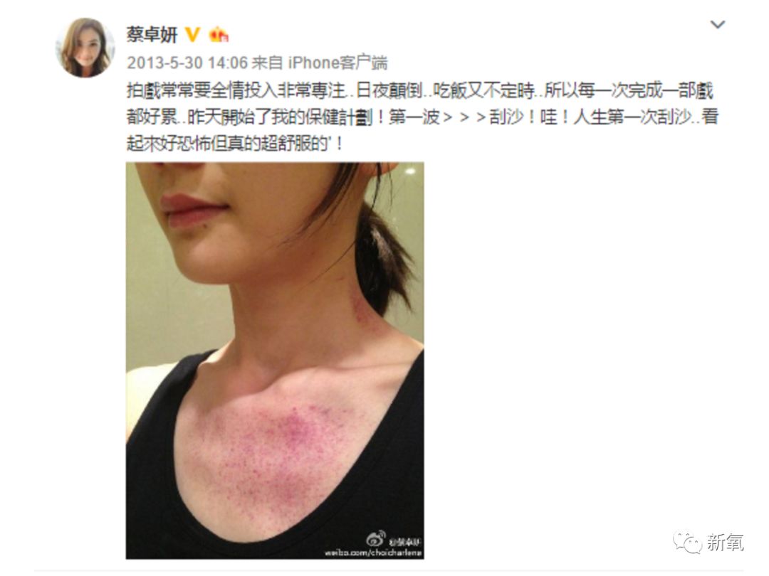 阿娇晒出的这张照片,看过的人都炸了!医生都看不下去了