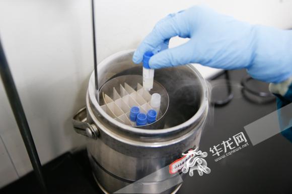 该给你的精子上一份"保险"了 揭秘重庆市人类精子库自精保存流程