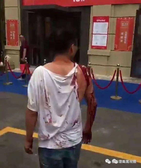 被砍伤被劫持济南一小区业主受伤真相调查