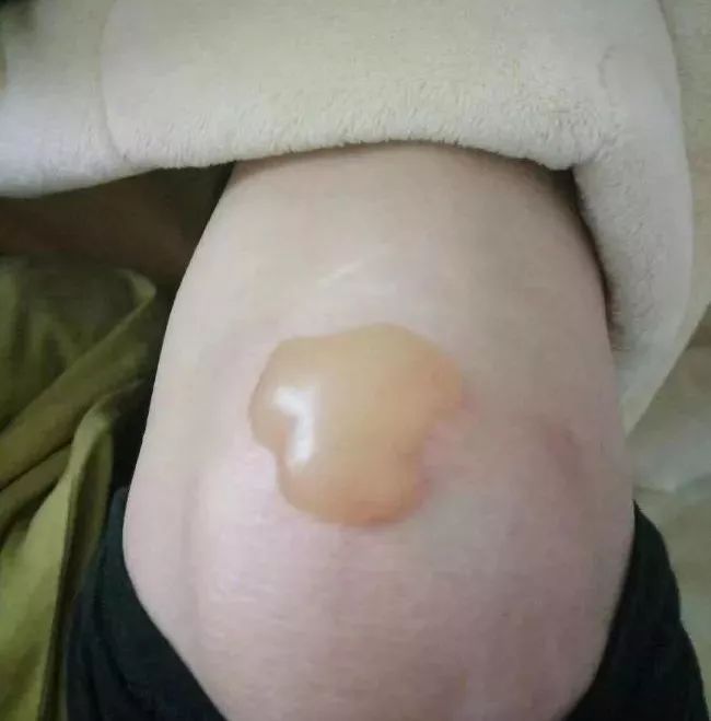 还有个事儿一定要当心.