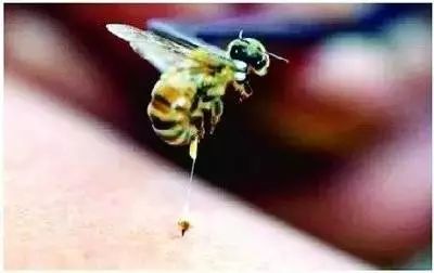 蜜蜂蛰了全身过敏图片图片