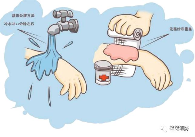 用清水充分冷却烧伤部位,用消毒纱布或干净布包扎;伤员发生休克时